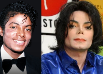 Why did Michael Jackson Get Plastic Surgery