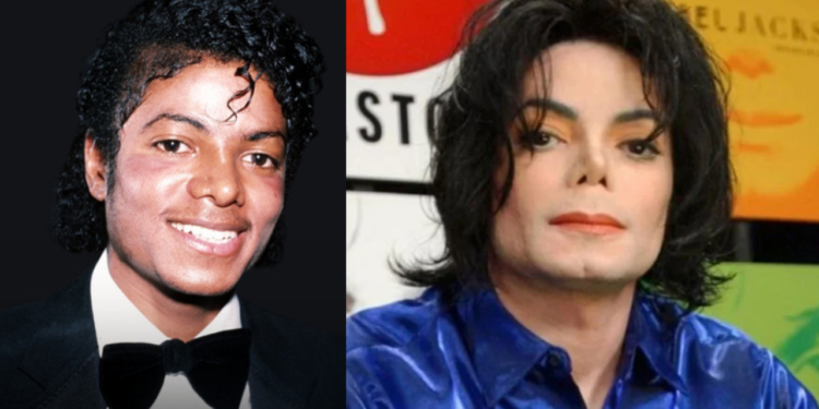 Why did Michael Jackson Get Plastic Surgery